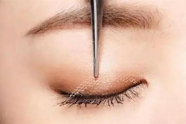 双眼皮贴能贴出永久双眼皮吗 双眼皮贴可以让眼睛变大吗 双眼皮贴能贴出永久双眼皮吗 双眼皮贴可以让眼睛变大吗