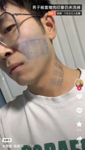 ​男子脸上被盖猪肉印章，洗不掉了