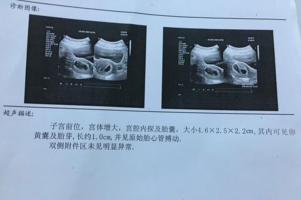 十男九漏是什么意思 怀男孩的象征在孕期第几周