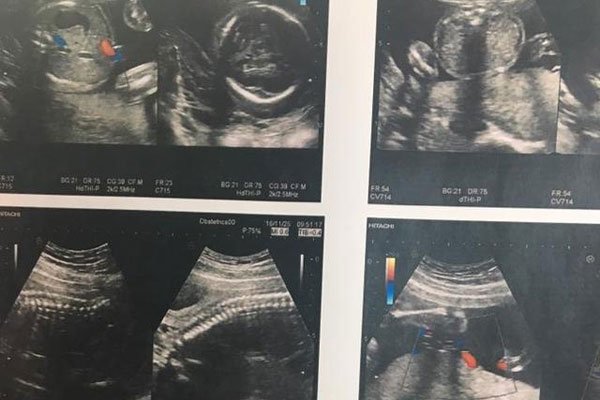 十男九漏是什么意思 怀男孩的象征在孕期第几周