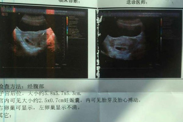 十男九漏是什么意思 怀男孩的象征在孕期第几周