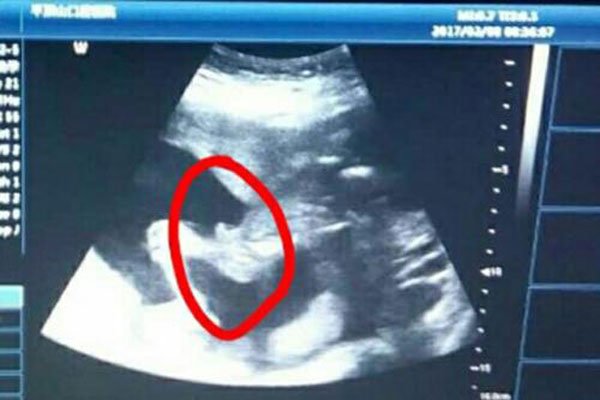 十男九漏是什么意思 怀男孩的象征在孕期第几周