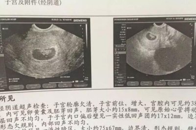​十男九漏是什么意思 怀男孩的象征在孕期第几周