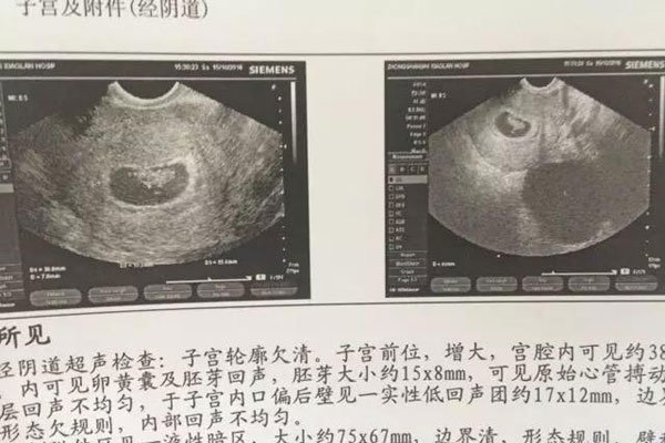 十男九漏是什么意思 怀男孩的象征在孕期第几周