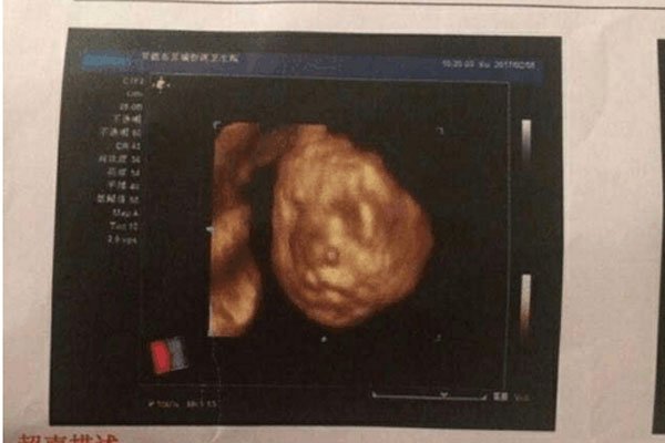 十男九漏是什么意思 怀男孩的象征在孕期第几周