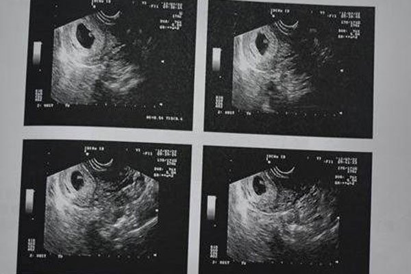 十男九漏是什么意思 怀男孩的象征在孕期第几周