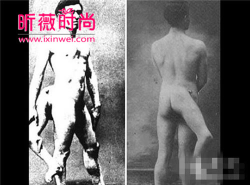 长了三条腿的人图片 长有3条腿的女人