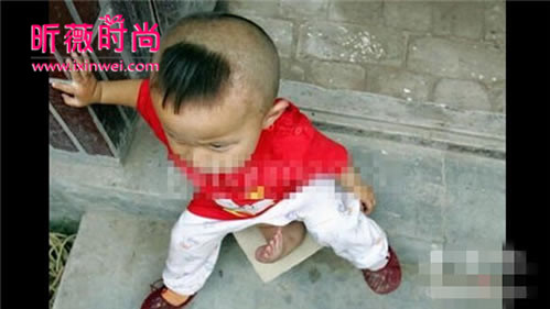 长了三条腿的人图片 长有3条腿的女人