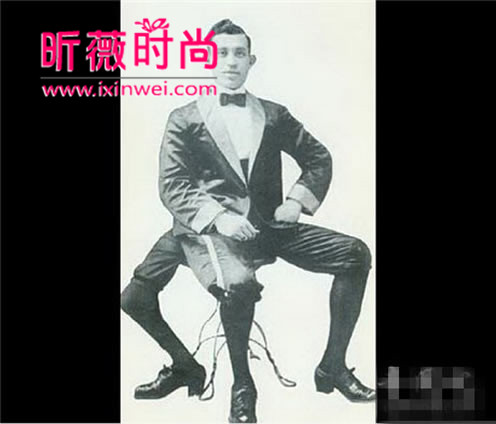 长了三条腿的人图片 长有3条腿的女人