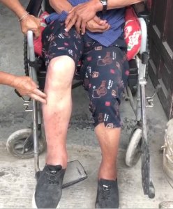 ​律师网购处方药被隔空诊断半身不遂案续：法院认定互联网医院违规开方