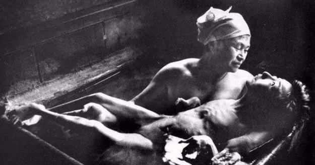 日本水俣病起因(非常典型的一例环境污染事件)(3)_