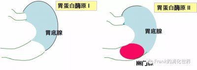 ​胃蛋白酶原i转角遇见你——血清胃蛋白酶原检测