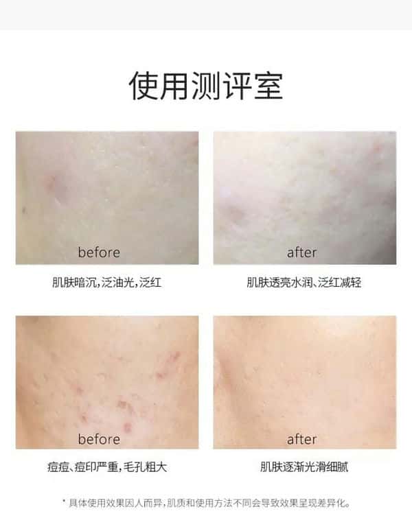 vt老虎面膜怎么样（vt老虎面膜）